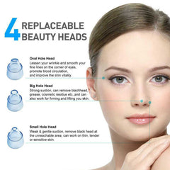 DermaSuction Pore Cleaning Device – Blackhead Remover & Facial Cleansing Tool