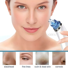 DermaSuction Pore Cleaning Device – Blackhead Remover & Facial Cleansing Tool