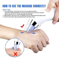 DermaSuction Pore Cleaning Device – Blackhead Remover & Facial Cleansing Tool