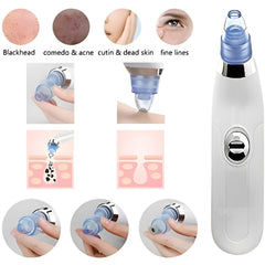 DermaSuction Pore Cleaning Device – Blackhead Remover & Facial Cleansing Tool