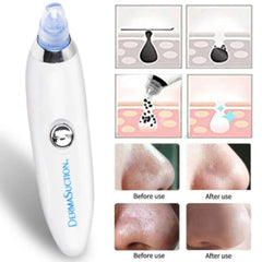 DermaSuction Pore Cleaning Device – Blackhead Remover & Facial Cleansing Tool